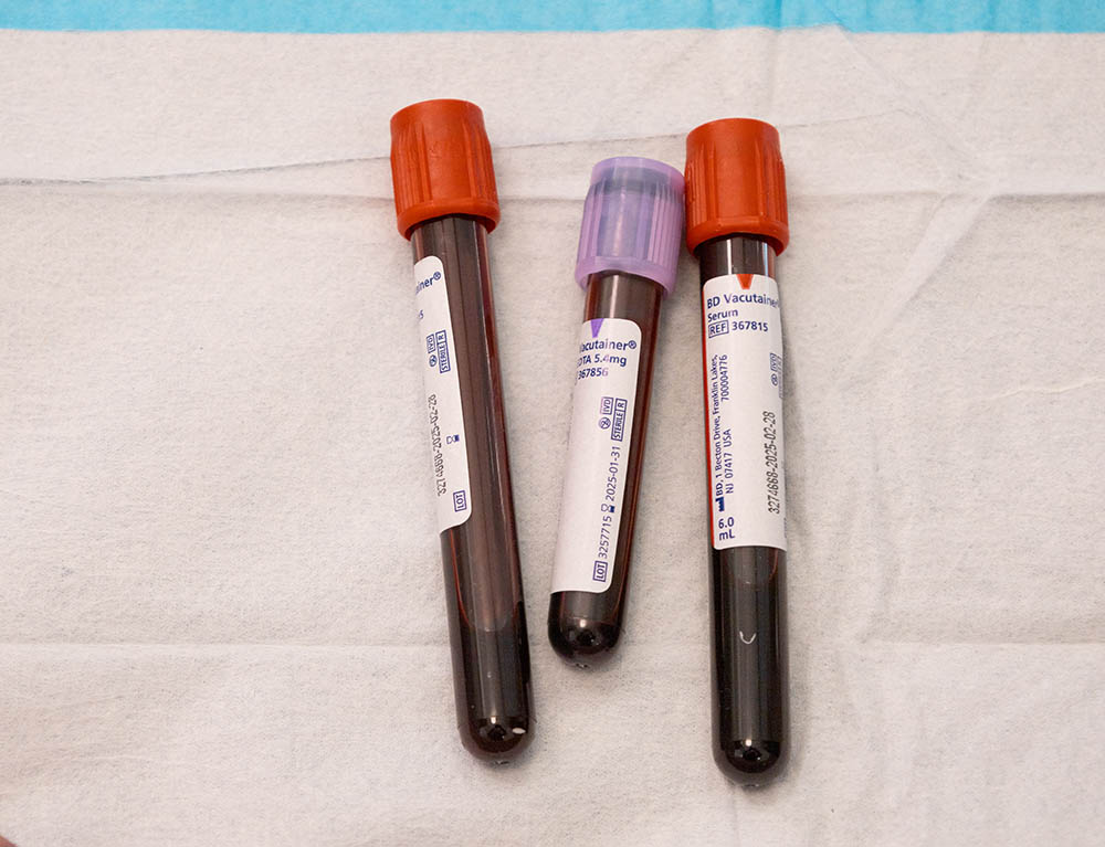 3 vials of blood on a sanitary surface